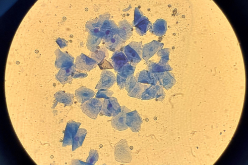 Progesterone Testing & Ovulation Cytology 